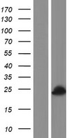 ls000266 amely human over expression lysates nm 001143 wb testing 1