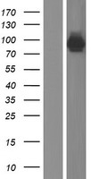 ls000270 ampd1 human over expression lysates nm 000036 wb testing 1