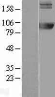 ls000271 ampd2 human over expression lysates nm 139156 wb testing 1