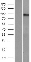 ls000272 ampd3 human over expression lysates nm 000480 wb testing 1