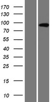 ls000272 ampd3 human over expression lysates nm 001025390 wb testing 2