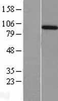 Amphiphysin (AMPH) Human Over-expression Lysates NM_001635