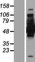 ls000274 bin1 human over expression lysates nm 139344 wb testing 2