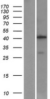 ls000275 aminomethyltransferase amt human over expression lysates nm 000481 wb testing 1