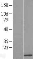 Angiogenin (ANG) Human Over-expression Lysates NM_001145