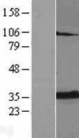 Adenine Nucleotide Translocator 2 (SLC25A5) Human Over-expression Lysates NM_001152