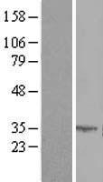 SLC25A6 Human Over-expression Lysates NM_001636