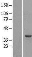 ls000301 annexin a1 anxa1 human over expression lysates nm 000700 wb testing 1