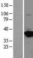 Annexin A2 (ANXA2) Human Over-expression Lysates NM_001002858