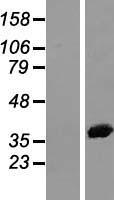 Annexin A2 (ANXA2) Human Over-expression Lysates NM_001136015