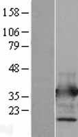 Annexin V (ANXA5) Human Over-expression Lysates NM_001154