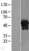 Annexin A11 (ANXA11) Human Over-expression Lysates NM_001157