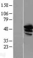 Annexin A11 (ANXA11) Human Over-expression Lysates NM_145868