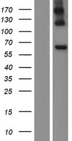 ls000313 acyloxyacyl hydrolase aoah human over expression lysates nm 001177507 wb testing 2