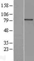 AOC2 Human Over-expression Lysates NM_001158