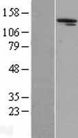 Aldehyde Oxidase (AOX1) Human Over-expression Lysates NM_001159