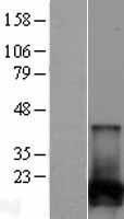 NUDT2 Human Over-expression Lysates NM_147173
