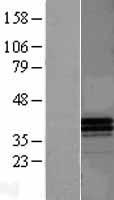 Apolipoprotein F (APOF) Human Over-expression Lysates NM_001638