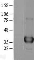 APE1 (APEX1) Human Over-expression Lysates NM_001641