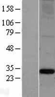 Apolipoprotein A I (APOA1) Human Over-expression Lysates NM_000039