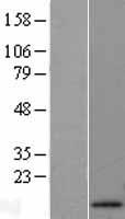 Apolipoprotein A II (APOA2) Human Over-expression Lysates NM_001643