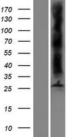 Aquaporin 8 (AQP8) Human Over-expression Lysates NM_001169