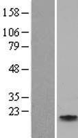 Apolipoprotein CIV (APOC4) Human Over-expression Lysates NM_001646