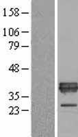 ls000348 apolipoprotein e apoe human over expression lysates nm 000041 wb testing 1