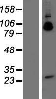 ls000351 amyloid precursor protein app human over expression lysates nm 201413 wb testing 2