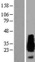 ls000353 aprt human over expression lysates nm 000485 wb testing 1