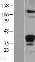 Fas Ligand (FASLG) Human Over-expression Lysates NM_000639