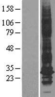 Aquaporin 1 (AQP1) Human Over-expression Lysates NM_198098
