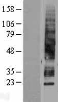 Aquaporin 3 (AQP3) Human Over-expression Lysates NM_004925