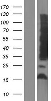 Aquaporin 4 (AQP4) Human Over-expression Lysates NM_004028