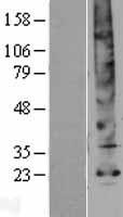 Aquaporin 5 (AQP5) Human Over-expression Lysates NM_001651
