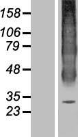 Aquaporin 6 (AQP6) Human Over-expression Lysates NM_001652
