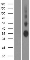 Aquaporin 7 (AQP7) Human Over-expression Lysates NM_001170