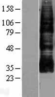 Aquaporin 9 (AQP9) Human Over-expression Lysates NM_020980