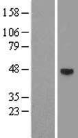 Androgen Receptor (AR) Human Over-expression Lysates NM_001011645