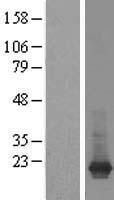 ls000375 arf1 human over expression lysates nm 001658 wb testing 4