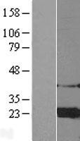 ARF4 Human Over-expression Lysates NM_001660
