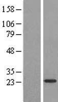 ARF4L (ARL4D) Human Over-expression Lysates NM_001661