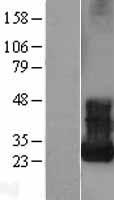 ARF5 Human Over-expression Lysates NM_001662