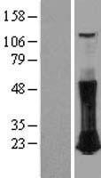 ls000389 rhoc human over expression lysates nm 001042678 wb testing 2