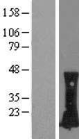 ls000389 rhoc human over expression lysates nm 001042679 wb testing 3