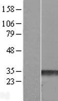 RND3 Human Over-expression Lysates NM_005168