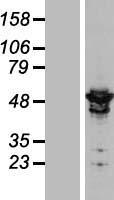 ARHGAP1 Human Over-expression Lysates NM_004308