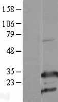 ls000396 rhogdi arhgdia human over expression lysates nm 004309 wb testing 2