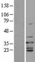 ls000397 d4 arhgdib human over expression lysates nm 001175 wb testing 1