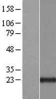 ARL 1 (ARL1) Human Over-expression Lysates NM_001177